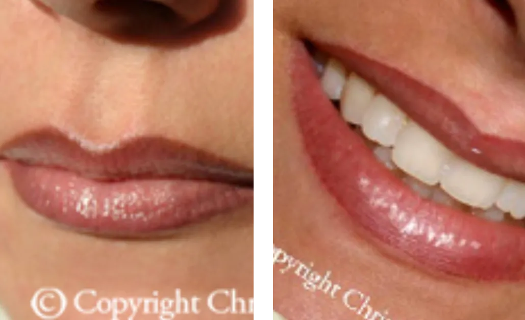 Zwei Nahaufnahmen rosiger Lippen: links geschlossen, rechts beim Lächeln mit sichtbaren Zähnen.
